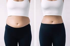 semaglutide compounded