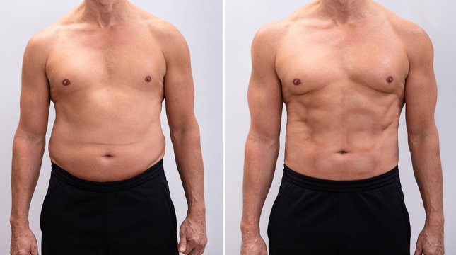 semaglutide dose for weight loss